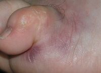 The Toe